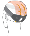 Occipitale-electrode.png