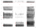 Spectrogram -iua-.png